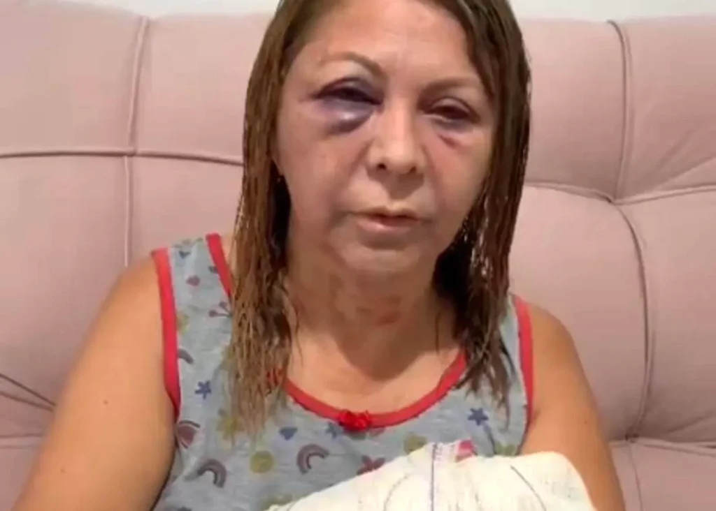 mulher agredida
